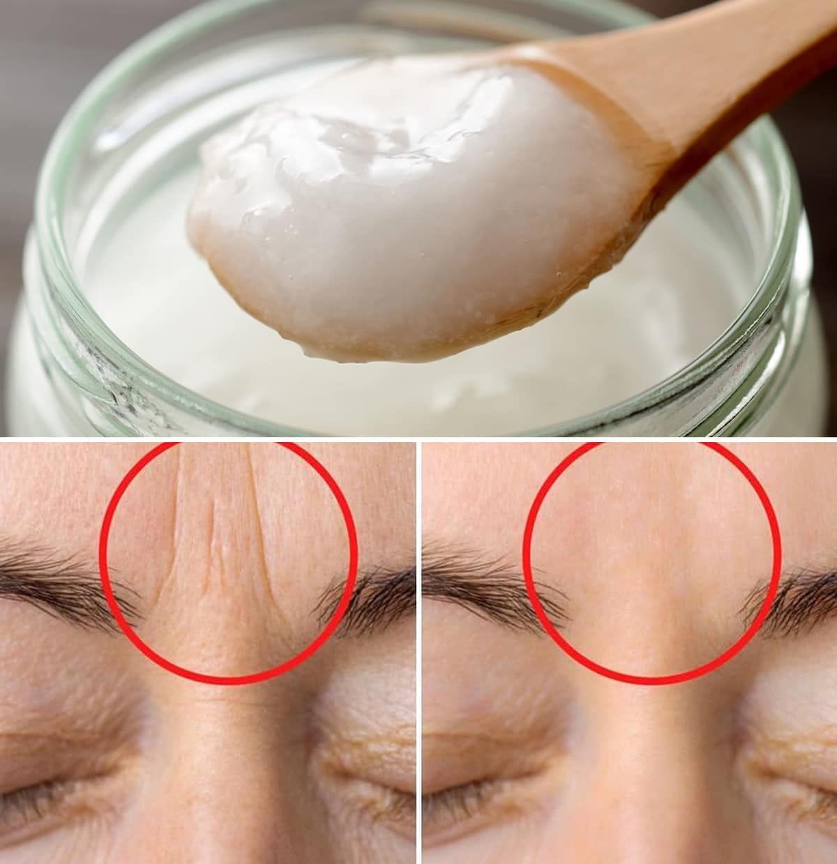 2 masks to eliminate wrinkles between the eyebrows 2 masks to eliminate wrinkles between the eyebrows