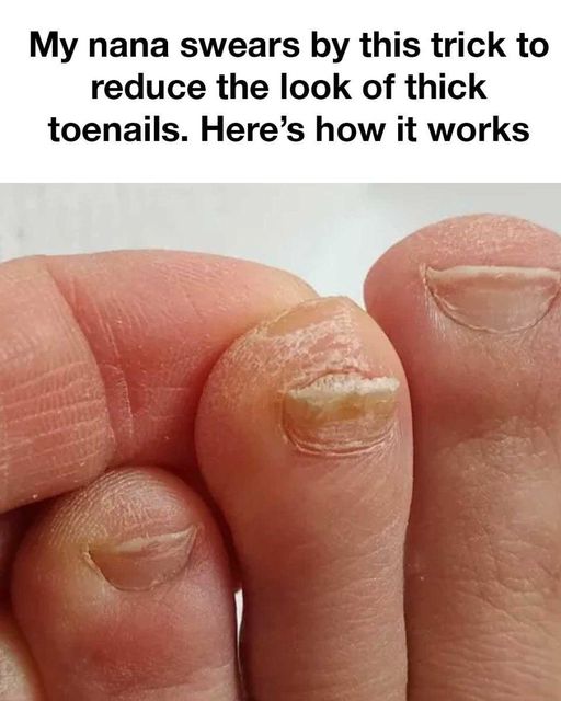 trick to reduce the look of thick toenails trick to reduce the look of thick toenails