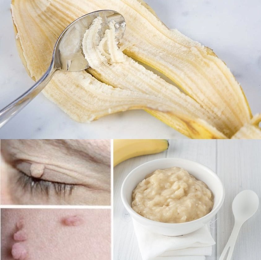 Unlocking the Secret: Banana Peel for Ageless Beauty – A Centuries-Old Recipe! Unlocking the Secret: Banana Peel for Ageless Beauty – A Centuries-Old Recipe!